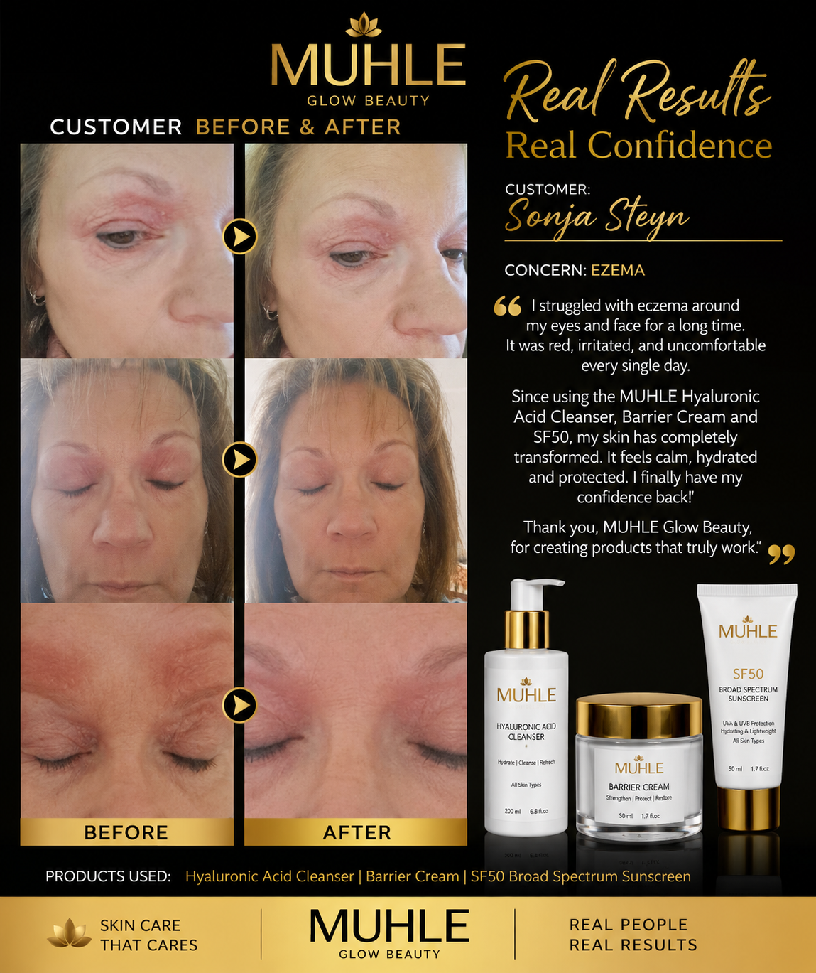 Sonja Steyn — before and after